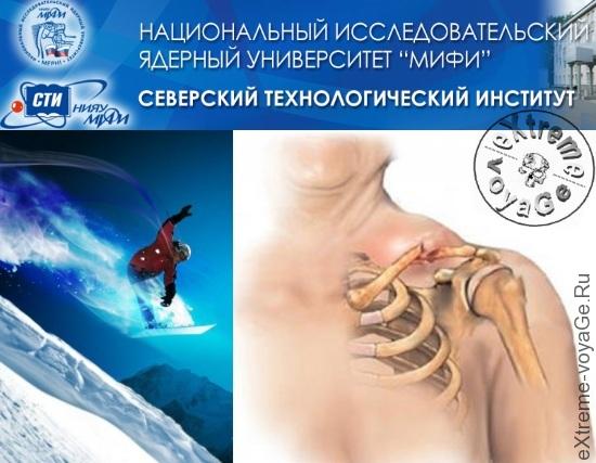 Русский костный цемент регенерирует кости человека